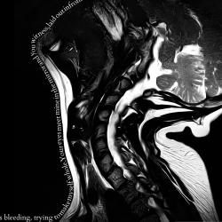 The Anatomy of Pain Original Soundtrack. Передняя обложка. Нажмите, чтобы увеличить. The Anatomy of Pain Original Soundtrack. Передняя обложка. Нажмите, чтобы увеличить.